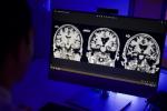 radiografía de un cerebro